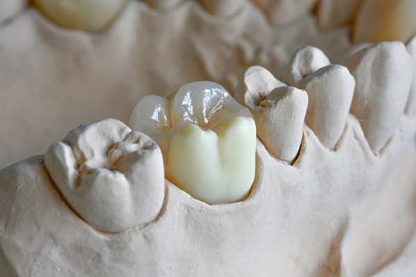 審美的な歯科治療